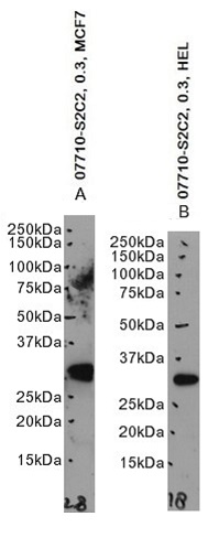 Goat Anti-Galectin 3 Antibody