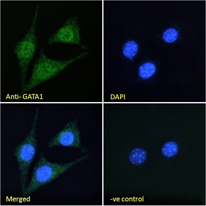 Goat Anti-GATA1 Antibody