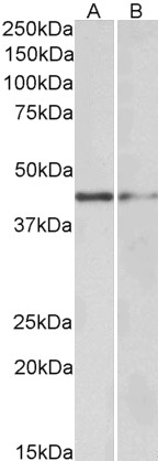 Goat Anti-GATA3 Antibody