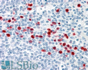 Goat Anti-GCC185 Antibody