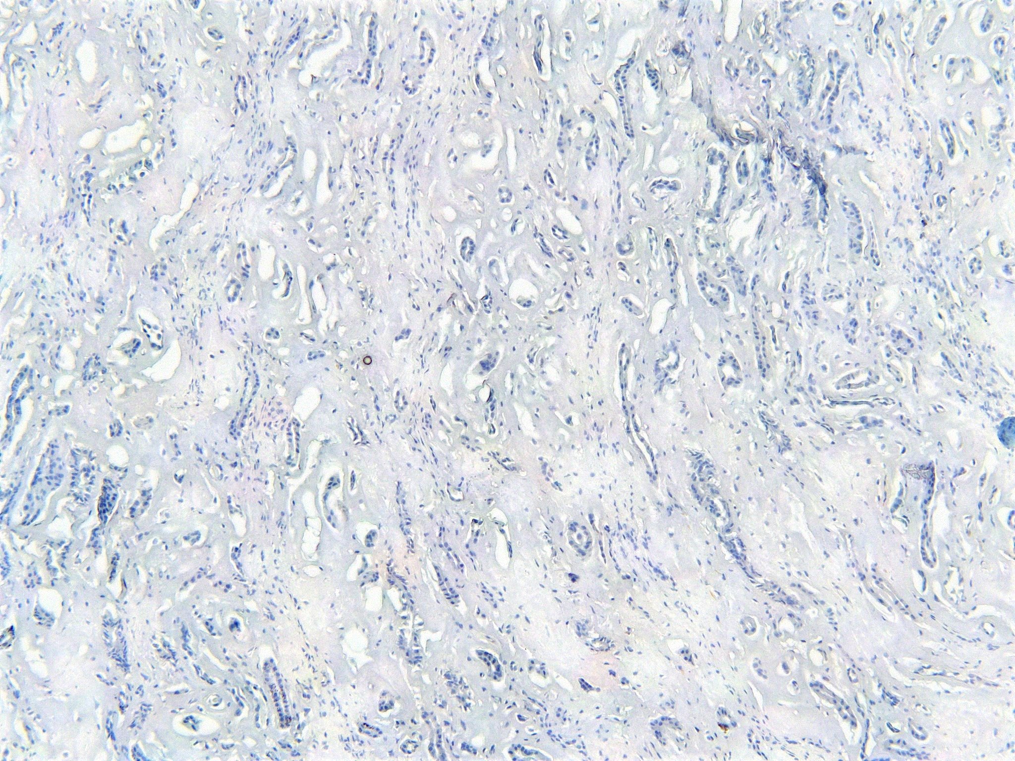 Goat Anti-GERP / TRIM8 Antibody