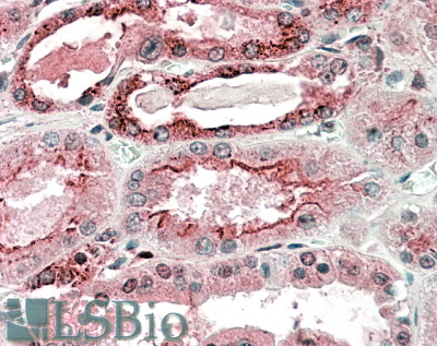 Goat Anti-GGCX Antibody