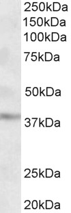 Goat Anti-MICS1 / GHITM (aa117-127) Antibody