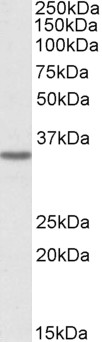 Goat Anti-MICS1 / GHITM Antibody