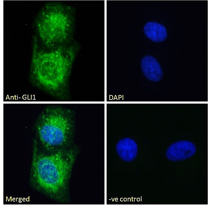 Goat Anti-GLI1 Antibody