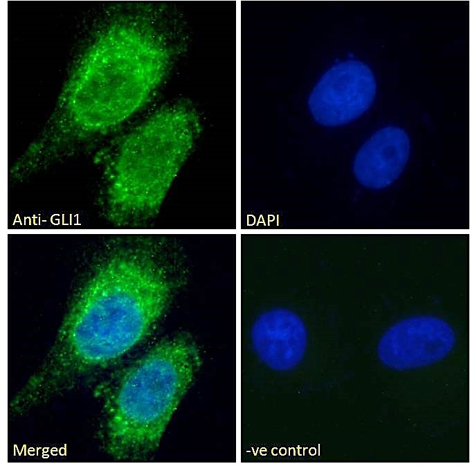 Goat Anti-GLI1 Antibody
