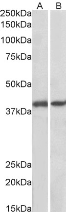 Goat Anti-GNAQ / ALPHA-q (aa162-175) Antibody