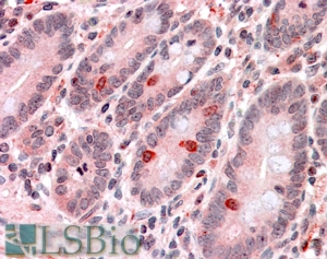 Goat Anti-GNAT3 Antibody