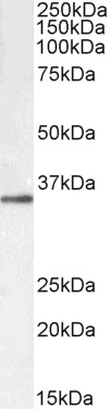 Goat Anti-GNB3 & GNB4, Biotinylated Antibody