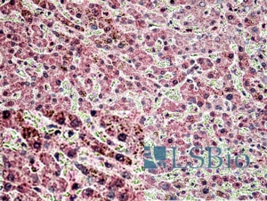 Goat Anti-GOLGA4 / Golgin-245 Antibody