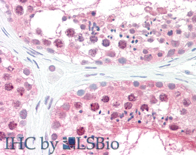 Goat Anti-GPS1 / COPS1 Antibody