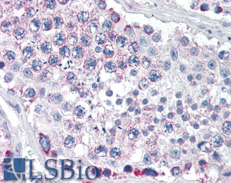 Goat Anti-GPSM2 Antibody