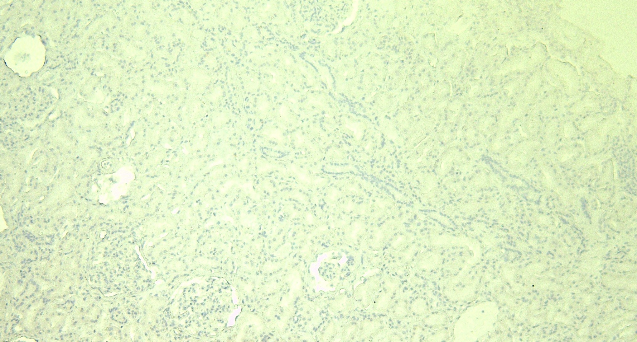 Goat Anti-GPX3 Antibody