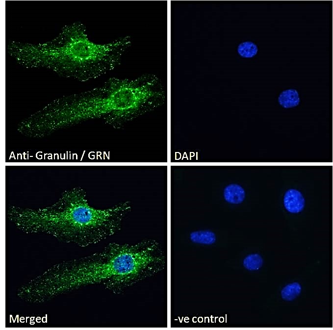 Goat Anti-Granulin / GRN Antibody