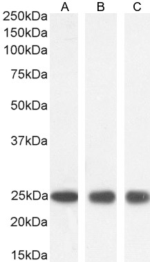 Goat Anti-GST3 / GSTP1 Antibody