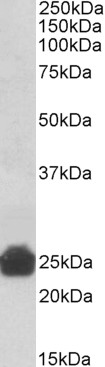 Goat Anti-Gsta3/Gsta5/Gst Yc2 (rat) Antibody
