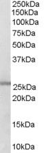 Goat Anti-GSTM1 / GSTM2 Antibody