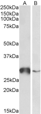 Goat Anti-GSTO1 Antibody