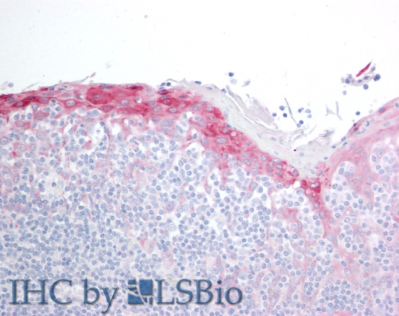 Goat Anti-H11 / HSP22 Antibody