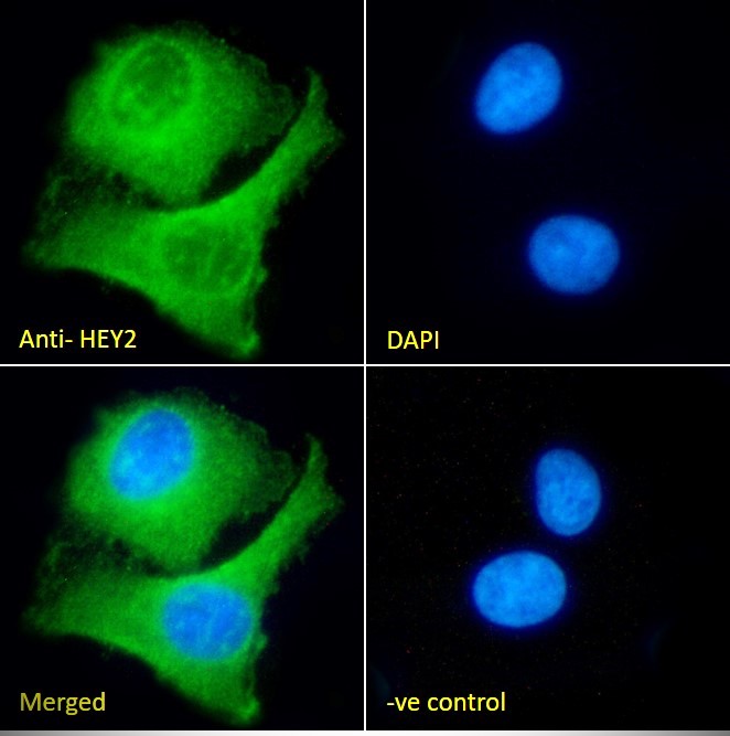 Goat Anti-HEY2 Antibody