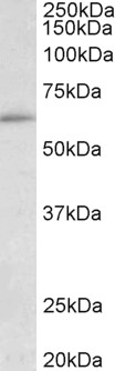 Goat Anti-HIC2 (aa188-200) Antibody