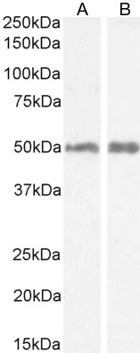 Goat Anti-Histamine Receptor H2 (aa309-323) (mouse) Antibody