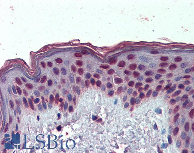 Goat Anti-HMGA1 (aa9-21) Antibody