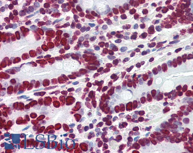 Goat Anti-HMGA1 Antibody