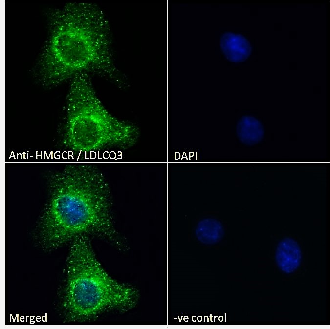 Goat Anti-HMGCR / LDLCQ3 Antibody