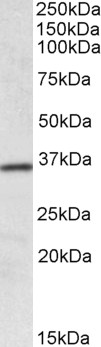 Goat Anti-HOXA4 Antibody
