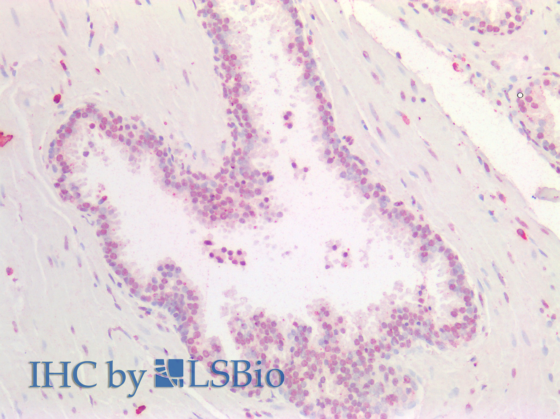 Goat Anti-HOXA5 (aa157-168) Antibody