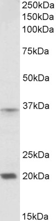 Goat Anti-HOXA9 (aa49-60) Antibody
