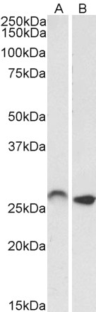 Goat Anti-HOXC6 (isoform 1) Antibody