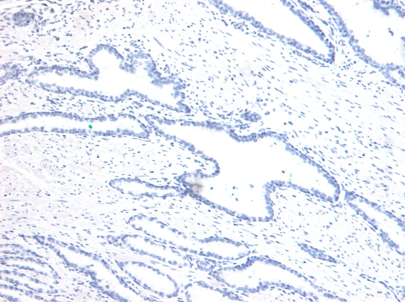 Goat Anti-HOXD13 Antibody