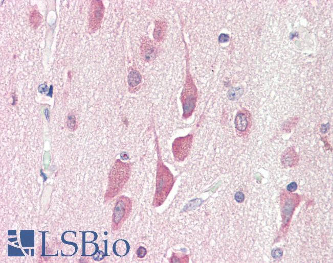 Goat Anti-HPS6 Antibody