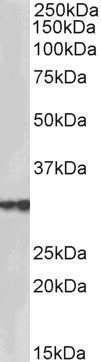 Goat Anti-HSD17B3 (aa141-155) Antibody
