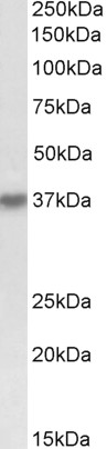 Goat Anti-HSH2D Antibody