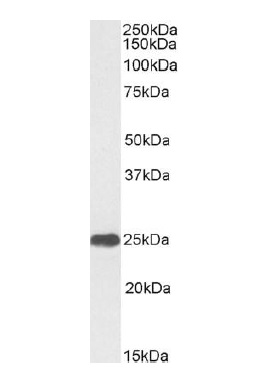 Goat Anti-Human C-reactive protein antibody (HRP) Antibody