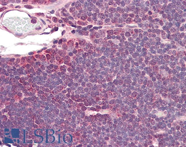 Goat Anti-IDH3A Antibody