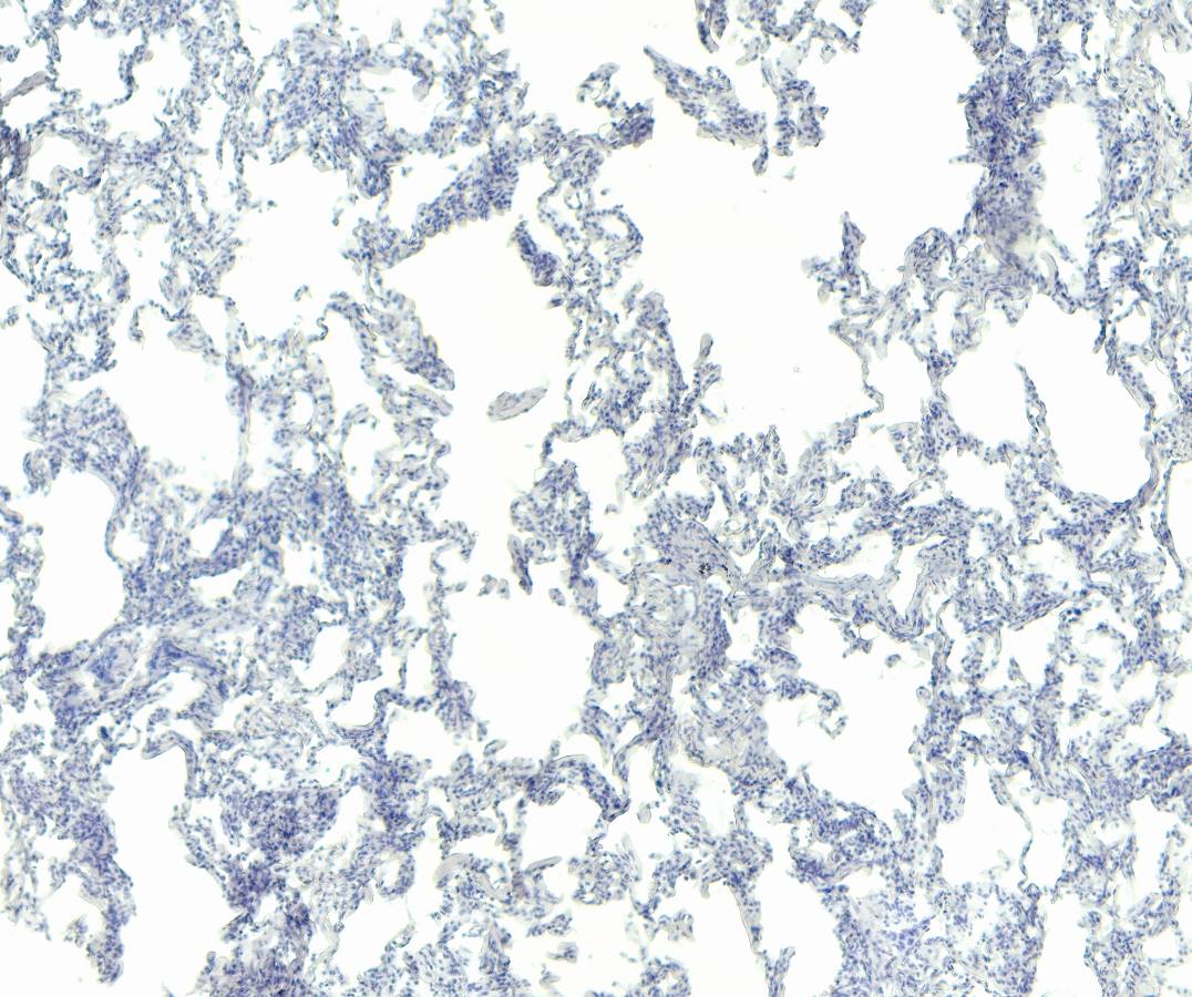Goat Anti-IFNGR1 (aa181-193) Antibody