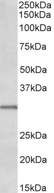 Goat Anti-IGFBP1 Antibody