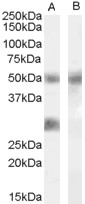 Goat Anti-IGFBP3 Antibody