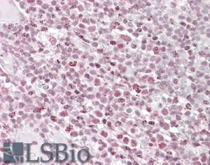 Goat Anti-IKAROS / IKZF1 Antibody