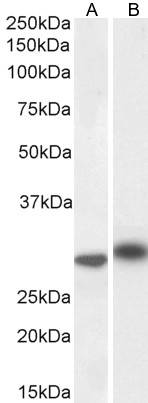 Goat Anti-IL-1 beta Antibody