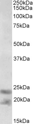 Goat Anti-IL-25 / IL-17E (aa66-79) Antibody