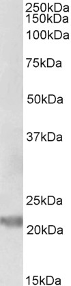 Goat Anti-IL-25 / IL-17E Antibody