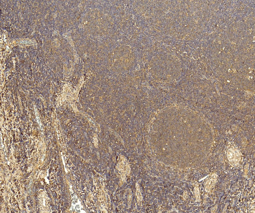 Goat Anti-IL-6 (aa138-148) Antibody