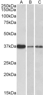 Goat Anti-IL12B / IL12p40 Antibody