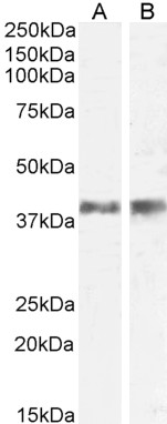Goat Anti-Il12b / Il12p40 (mouse) Antibody