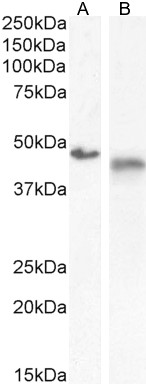 Goat Anti-IL1R2 Antibody
